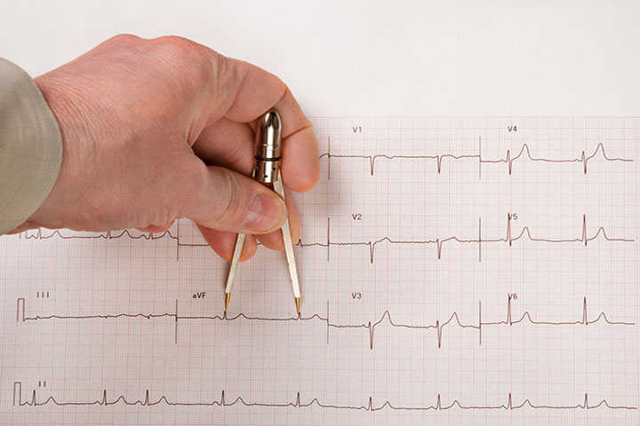 Masterclass in Advanced Electrocardiography | Advanced ECG Courses