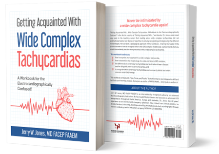 Wide Complex Tachycardias Paperback 3D - 2
